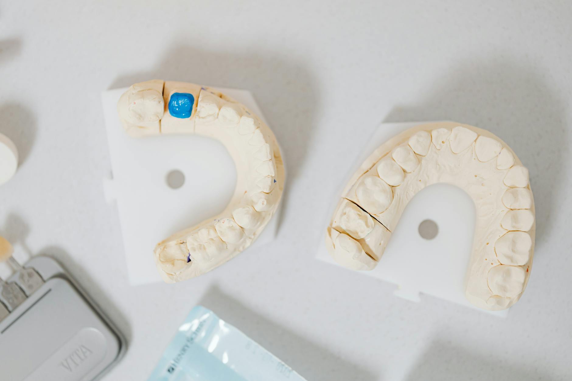 dental teeth cast models on table